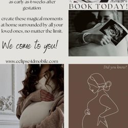 Eclipse 4D Mobile Ultrasounds - We come to you!