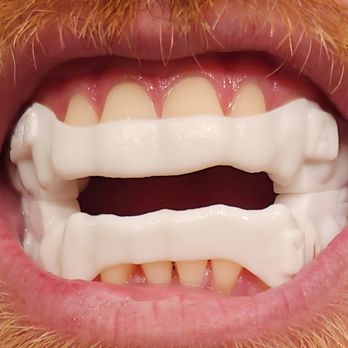 Hawkes Dental - General Dentistry Near Me - Litchfield, Michigan Hawkes Dental - General Dentistry Near Me - Litchfield, Michigan