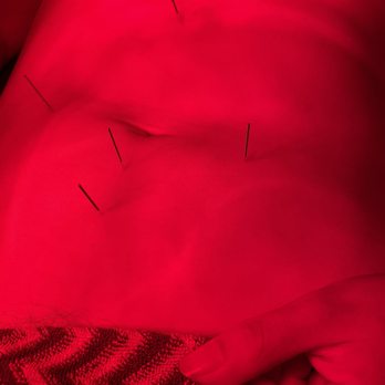 Green Acupunture - Basic points for internal issues,,,, - Acupuncture Near Me - Oxnard, California Green Acupunture - Basic points for internal issues,,,, - Acupuncture Near Me - Oxnard, California