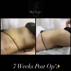 Studio ProSculpt