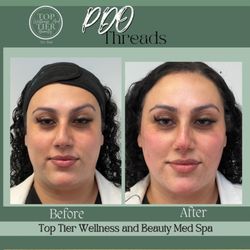 Top Tier Wellness And Beauty Aesthetics