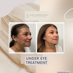 Pure Dermatology Cosmetic & Hair Center - Clear & Brilliant
