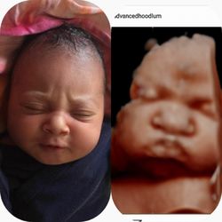 Little Beginnings 4D HD Ultrasound Studio
