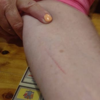 Lamberts Cafe - Moms scratch from the roll hitting her - American Near Me - Sikeston, Missouri Lamberts Cafe - Moms scratch from the roll hitting her - American Near Me - Sikeston, Missouri