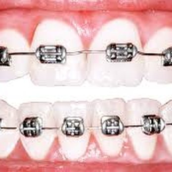 Your Total Dental & Orthodontics - Temple - Family Dentistry in Temple TX - Orthodontists Near Me - Temple, Texas Your Total Dental & Orthodontics - Temple - Family Dentistry in Temple TX - Orthodontists Near Me - Temple, Texas
