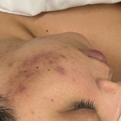 Desert Med Aesthetics - Before photo