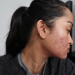 NB Skincare
