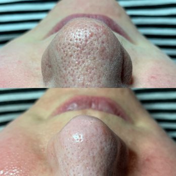 Skinsanity - Skin Care Near Me - Denver, Colorado Skinsanity - Skin Care Near Me - Denver, Colorado