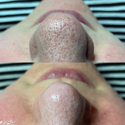 Skinsanity