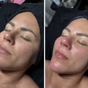 Estheticallyxe - Anti-Aging Facial - Estheticians Near Me - Valley Center, California Estheticallyxe - Anti-Aging Facial - Estheticians Near Me - Valley Center, California