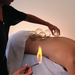 Orlando Natural Medicine And Acupuncture Clinic - We offer Cupping
