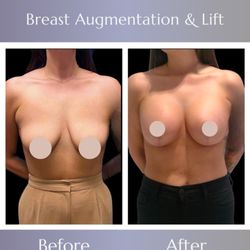 Sanam Zahedi, MD - Zahedi Plastic Surgery