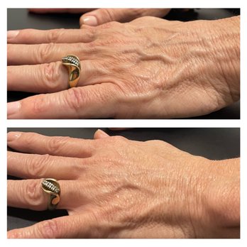 Beautiful Skin Nursing - Hand restoration - Skin Care Near Me Beautiful Skin Nursing - Hand restoration - Skin Care Near Me