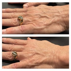 Beautiful Skin Nursing - Hand restoration
