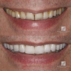 Brookline Progressive Dental Team - Heavy grinder? No problem. We are here to help you get your beautiful smile back!