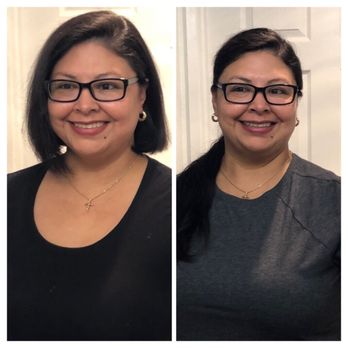 Arnol Salon & Spa - Right side was before & Left side was after!!!! - Skin Care Near Me - Glendale, California Arnol Salon & Spa - Right side was before & Left side was after!!!! - Skin Care Near Me - Glendale, California