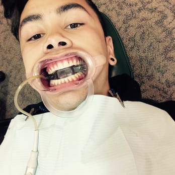 Carey B Noorda, DDS MSD - Christopher during his treatment. Handsome! Lol - Orthodontists Near Me - Henderson, Nevada Carey B Noorda, DDS MSD - Christopher during his treatment. Handsome! Lol - Orthodontists Near Me - Henderson, Nevada