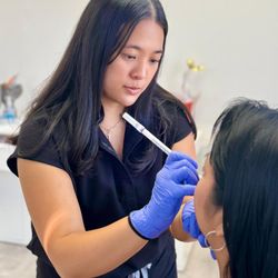 Botox Treatments