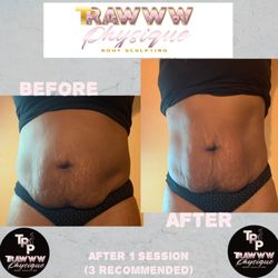 Rawww Physique Body Sculpting - Before and after Lipo cavitation session
