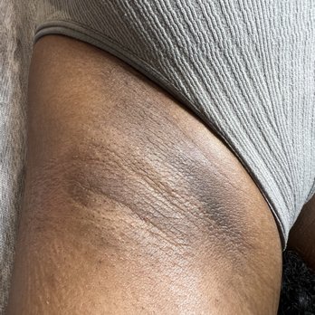 Stripped - After - Waxing Near Me - San Leandro, California