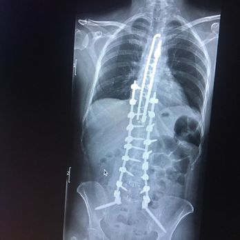 Denver International Spine Center - Medical Centers Near Me - Denver, Colorado Denver International Spine Center - Medical Centers Near Me - Denver, Colorado