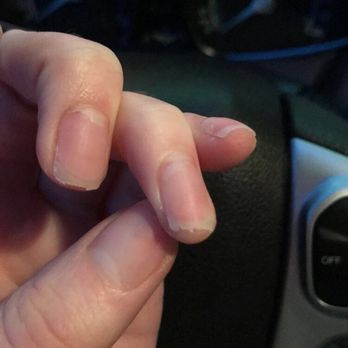 Luxury Nail Bar - Shredded nails from a half assed acrylic quick removal which I was charged $20 for - Nail Salons Near Me - Clackamas, Oregon Luxury Nail Bar - Shredded nails from a half assed acrylic quick removal which I was charged $20 for - Nail Salons Near Me - Clackamas, Oregon