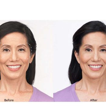 Dr Midas Medical Group - Weight Loss Centers Near Me - Rowland Heights, California Dr Midas Medical Group - Weight Loss Centers Near Me - Rowland Heights, California