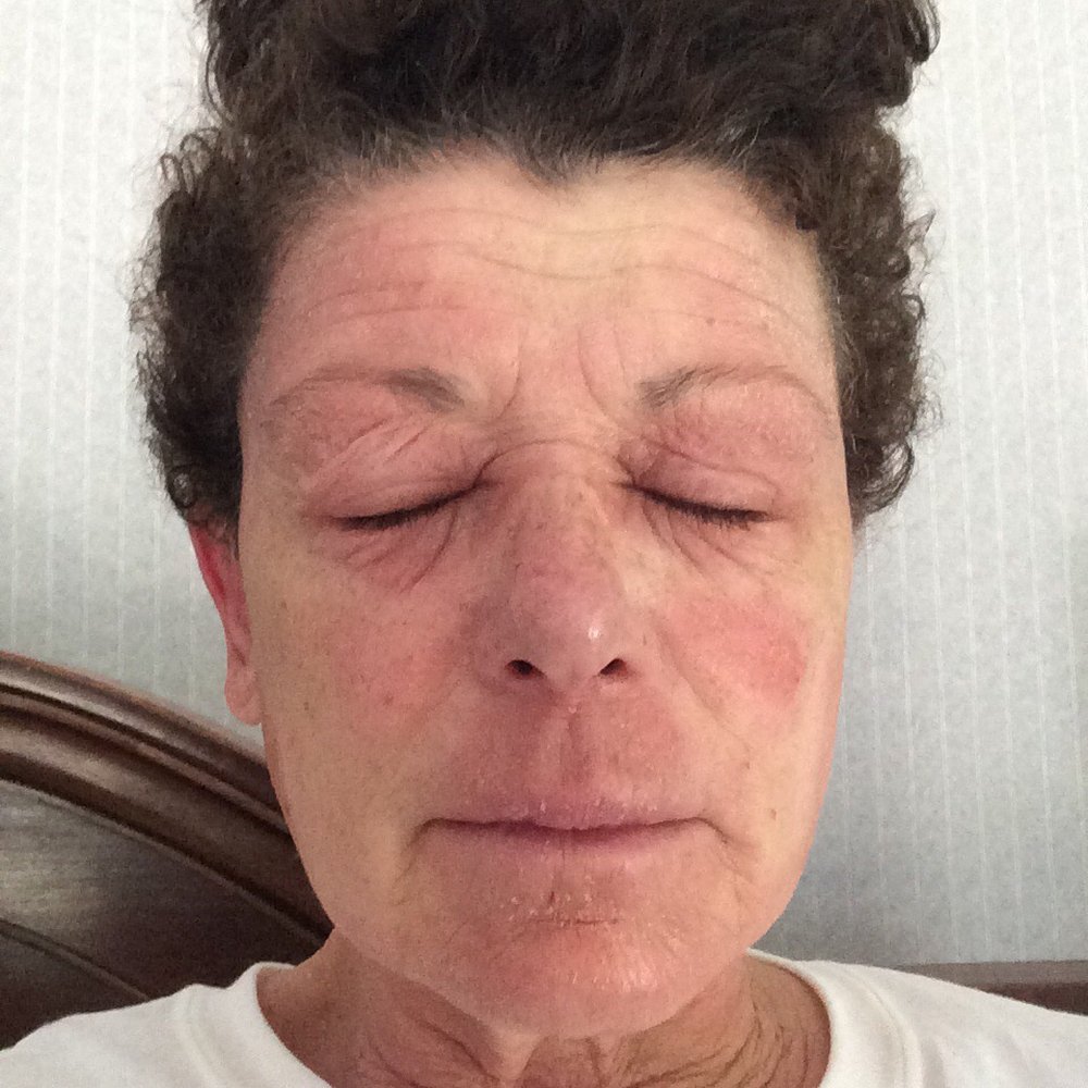 Southern Tier Dermatology - Dermatologists Near Me - Endwell, New York
