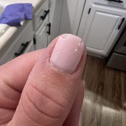 Shattered under the clear coat, chipped twice- after being "fixed" Shattered under the clear coat, chipped twice- after being "fixed"