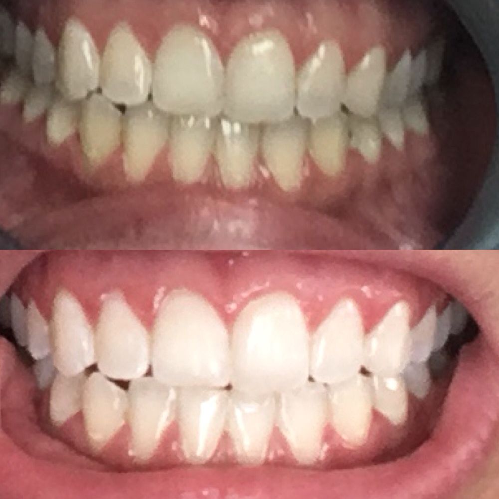 Before (top) after (bottom)
