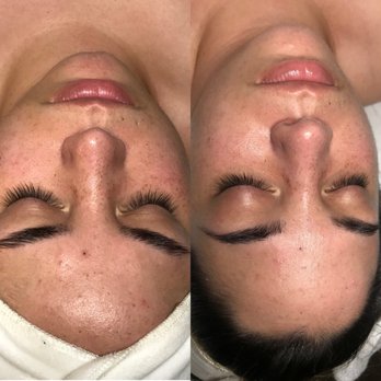 Esthetics By Brenna - Skin Care Near Me