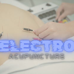 Dr. Mark VanOtterloo, DAOM - Add electrostimulation to any acupuncture treatment for added pain reducution.