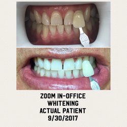 Orange Tree Dental - At Orange Tree Dental we offer Zoom in-office whitening. We have seen amazing results! Call our office if you would like to know more.