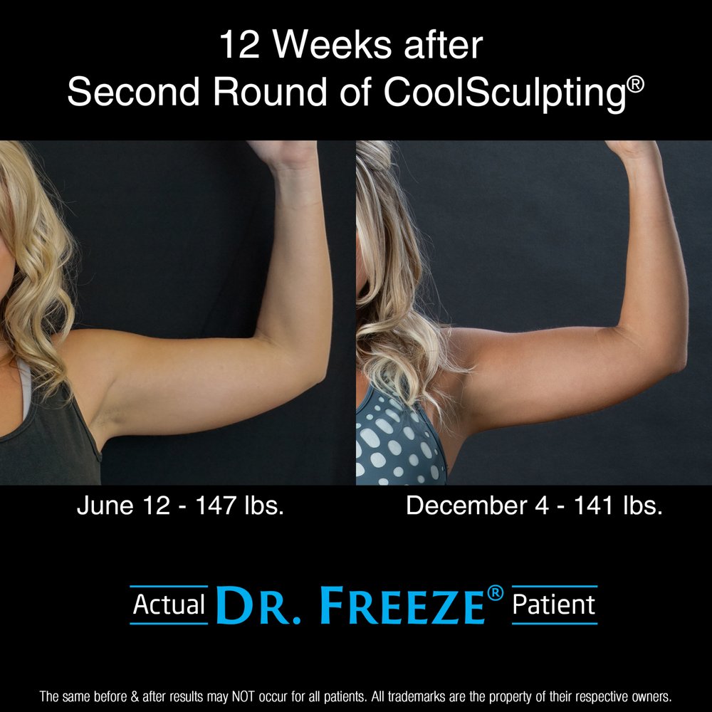 Dr. Freeze CoolSculpting Center Logo