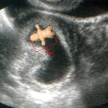 L.A.B. Look At Baby - L.A.B. Look At Baby - Mobile Ultrasound Test, 3D Ultrasound - Diagnostic Imaging Near Me - Orange, Texas L.A.B. Look At Baby - L.A.B. Look At Baby - Mobile Ultrasound Test, 3D Ultrasound - Diagnostic Imaging Near Me - Orange, Texas