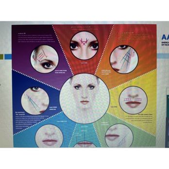 Snatched AZ - PDO threads areas of treatment - Medical Spas Near Me - Phoenix, Arizona Snatched AZ - PDO threads areas of treatment - Medical Spas Near Me - Phoenix, Arizona