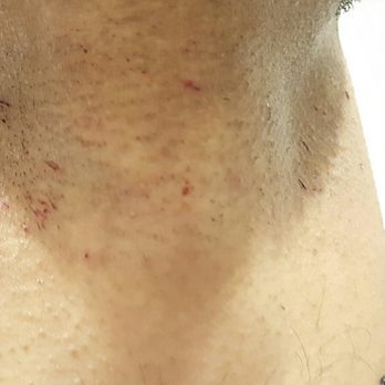 Doc Barnet Barber Shop - Left with cuts all over my neck for £11 They advertise prices as "from £X" so that they can make up prices on the spot  Complete joke.. - Barbers Near Me - London, XGL