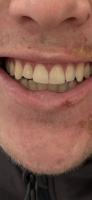 Colorado Healthy Smiles