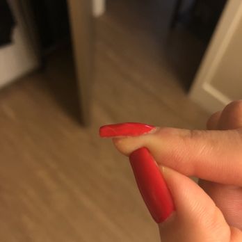 Creative Nails & Spa - A week later, a broken nail with bubbling uneven edges and a broken nail (by Kim) - Nail Salons Near Me - West Covina, California Creative Nails & Spa - A week later, a broken nail with bubbling uneven edges and a broken nail (by Kim) - Nail Salons Near Me - West Covina, California