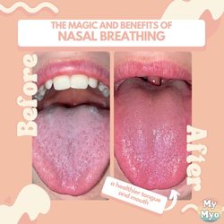 My Myo My Health Myofunctional Therapy - Nasal breathing keeps the mouth moist, healthy and prevents bad bacterial growth (cavities)! Early intervention is crucial!