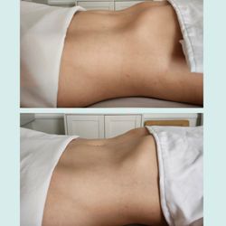 Before and after one wellness session.