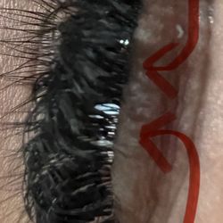 Threading By Raj - The clusters attached directly to the eyelid.  Told me that was normal.