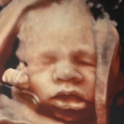 3D 4D Ultrasound by 4D Special Delivery