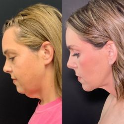 Robb Facial Plastic Surgery - Dr. Philip K. Robb Jr