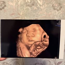 Baby’s First Glance - My baby's picture