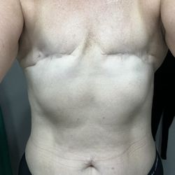 Ginger Slack, MD - Before my surgery w Dr Slack