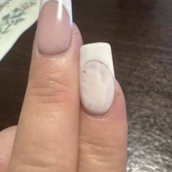 Sun Nails & Spa - What is that!!! The finger on the right in case you can't tell? - Nail Salons Near Me - Dundalk, Maryland Sun Nails & Spa - What is that!!! The finger on the right in case you can't tell? - Nail Salons Near Me - Dundalk, Maryland