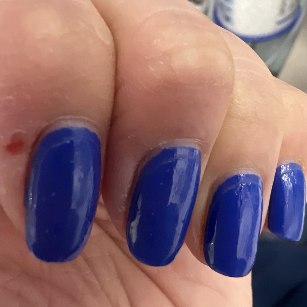 You see the "lines" throughout my nails"