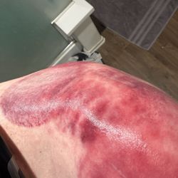 Cut Throat Massage