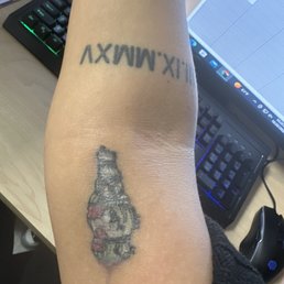 After the infection healed a bit. After the infection healed a bit.